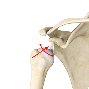 Multidirectional Instability of the Shoulder