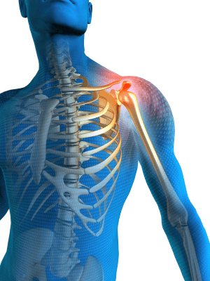 Shoulder Pain - Florida Ortho Care